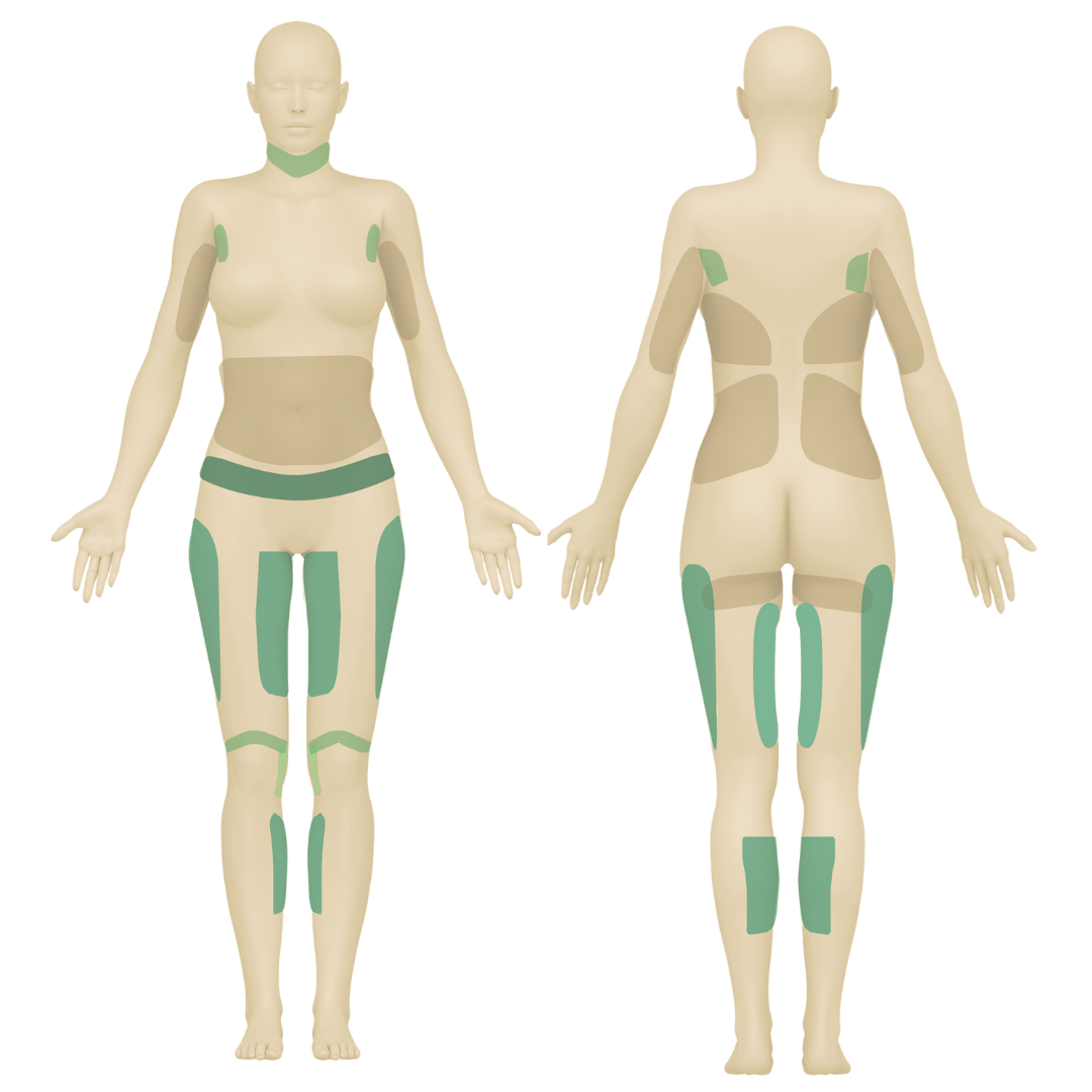 Cooltech areas REVU CLINIC