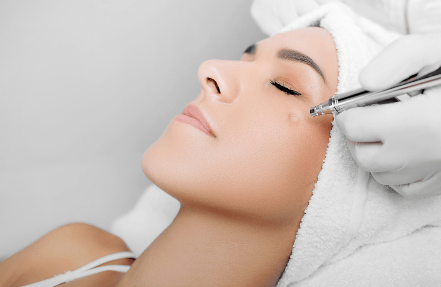 jet peel facial revu clinic