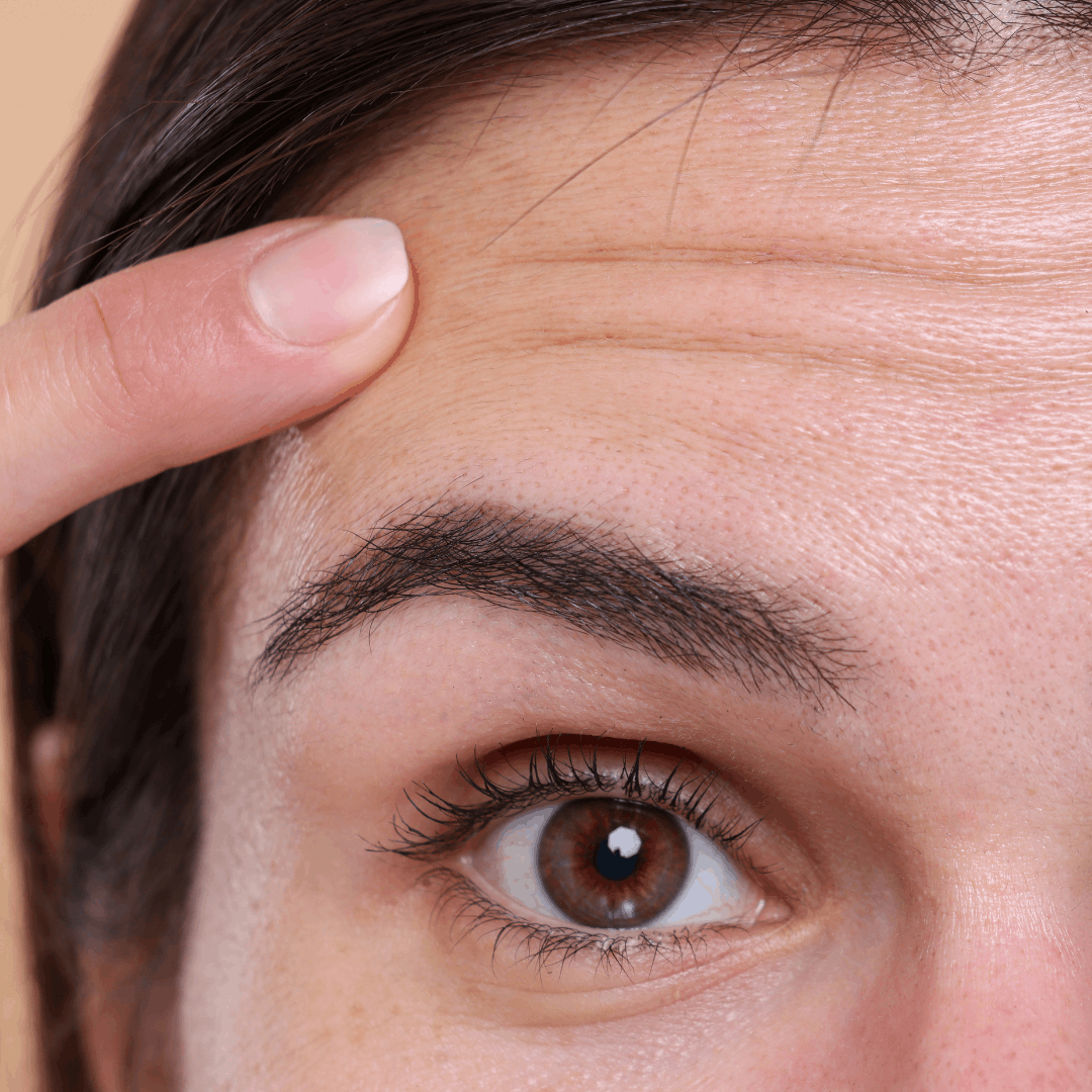 Botulinumtoxin Injektionen REVÙ CLINIC